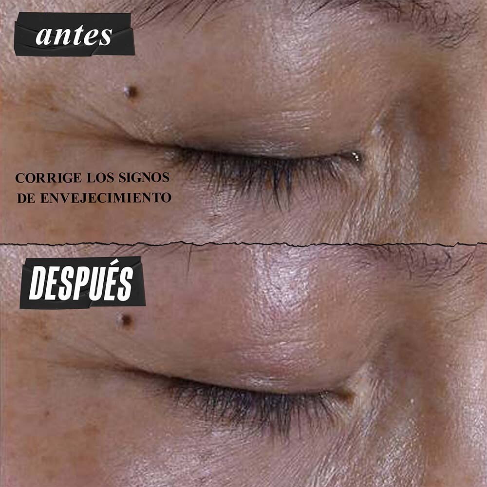 SUPER MULTI-CORRECTIVE EYE ZONE TREATMENT (CREMA ANTI-EDAD PARA CONTORNO DE OJOS)